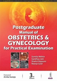 Postgraduate Manual of Obstetrics and Gynecology for Practical Examination