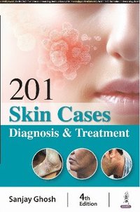 201 Skin Cases