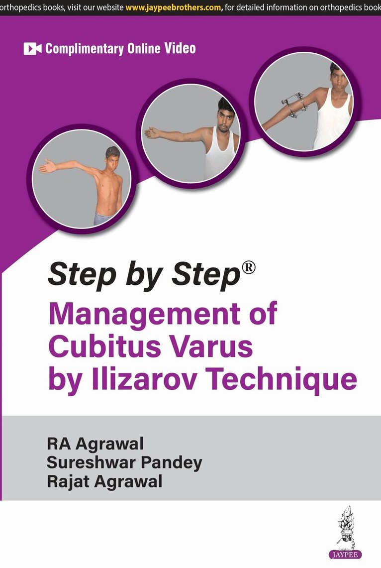 RA Agrawal, Sureshwar Pandey, Rajat Agrawal - Step by Step: Management of Cubitus Varus by Ilizarov Technique, Häftad