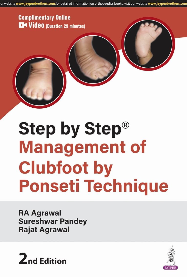 RA Agrawal, Sureshwar Pandey, Rajat Agrawal - Step by Step: Management of Clubfoot by Ponseti Technique, Häftad