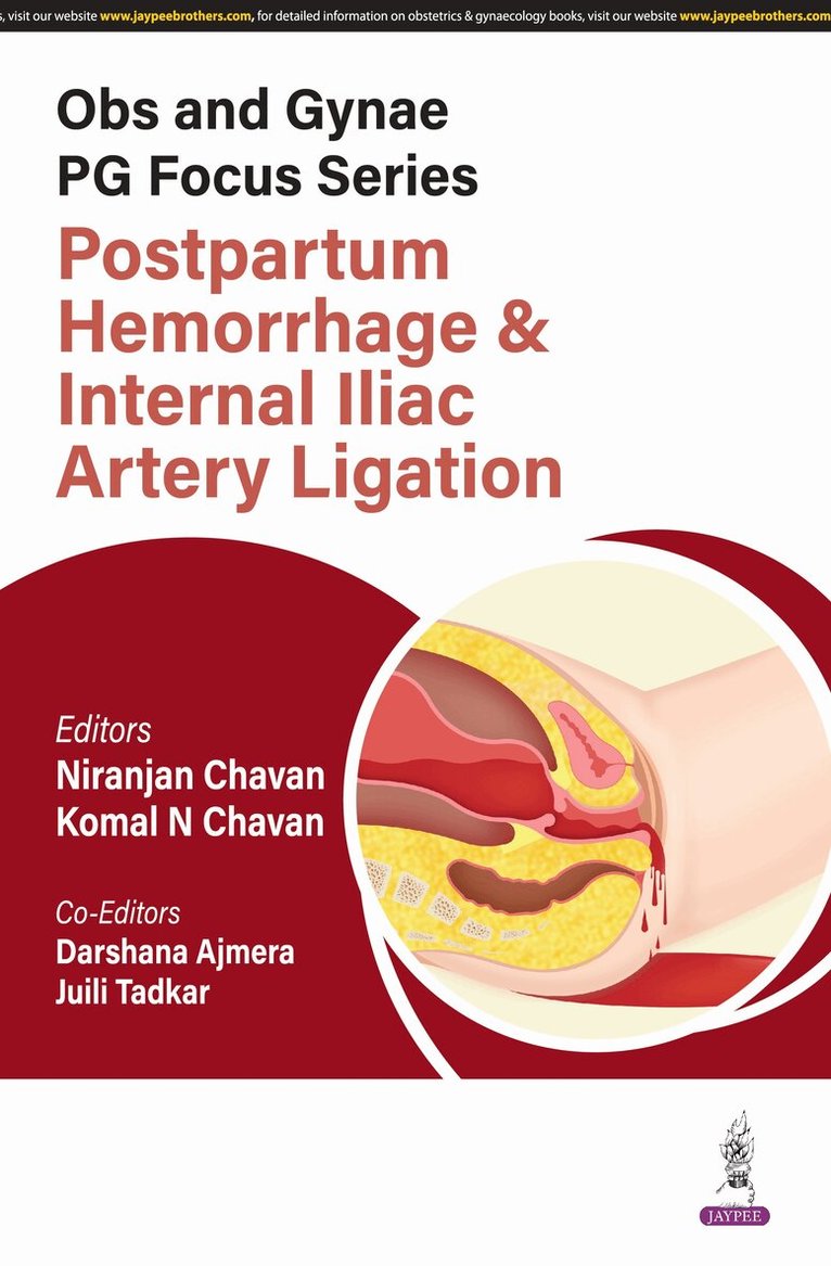 Niranjan Chavan, Komal N Chavan, Darshana Ajmera, Juili Tadkar - Obs and Gynae PG Focus Series: Postpartum Hemorrhage and Internal Iliac Artery Ligation, Häftad. Tillgänglighet: Lägg i varukorg