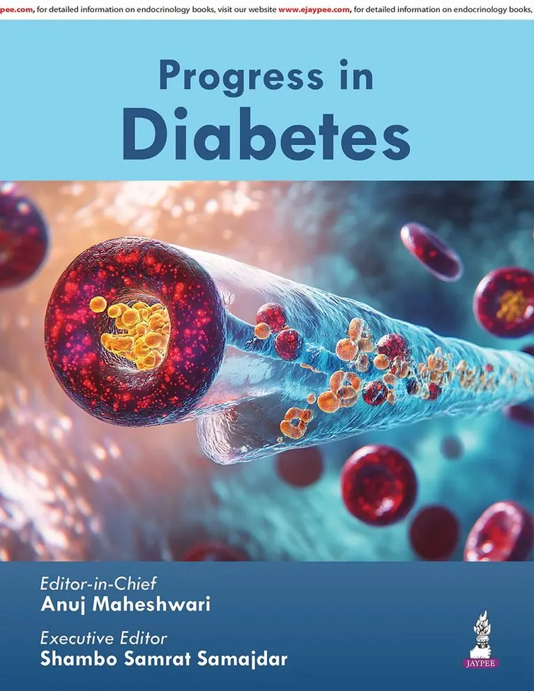 Anuj Maheshwari, Shambo Samrat Samajdar - Progress in Diabetes, Inbunden. Tillgänglighet: Tillfälligt slut