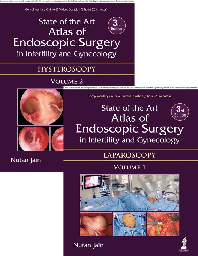Nutan Jain - State of the Art Atlas of Endoscopic Surgery in Infertility and Gynecology, Inbunden