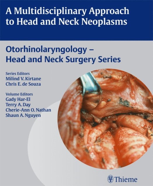 Cherie-Ann O. Nathan, Gady Har-El - Multidisciplinary Approach to Head and Neck Neoplasms, E-bok