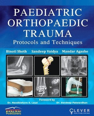 Binoti Sheth, Mandar Agashe - "PAEDIATRIC ORTHOPAEDIC TRAUMA Protocols and Techniques", Häftad