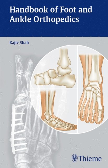 Rajiv Shah - Handbook of Foot and Ankle Orthopedics, E-bok