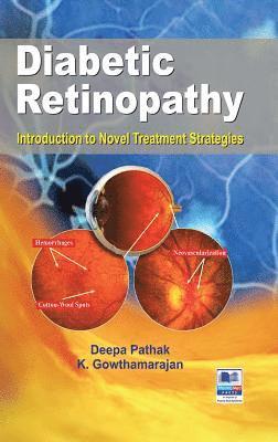 Deepa Pathak, K. Gowthamarajan - Diabetic Retinopathy: Introduction to Novel Treatment Strategies, Inbunden