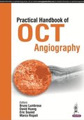 Practical Handbook of OCT Angiography