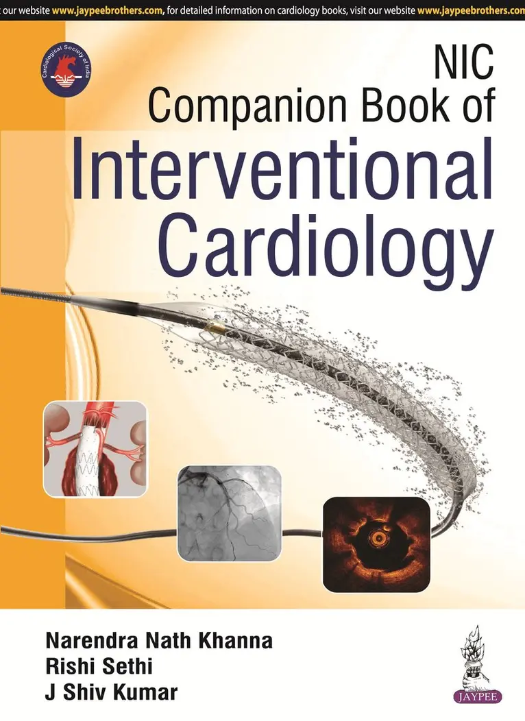Narendra Nath Khanna, Rishi Sethi, J Shiv Kumar - NIC Companion Book of Interventional Cardiology, Häftad. Tillgänglighet: Tillfälligt slut