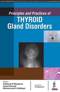 Principles and Practices of Thyroid Gland Disorders