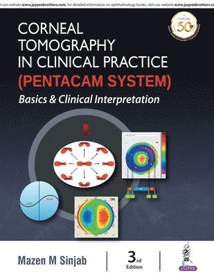 Mazen M. Sinjab - Corneal Tomography in Clinical Practice (Pentacam System): Basics and Clinical Interpretation, Häftad