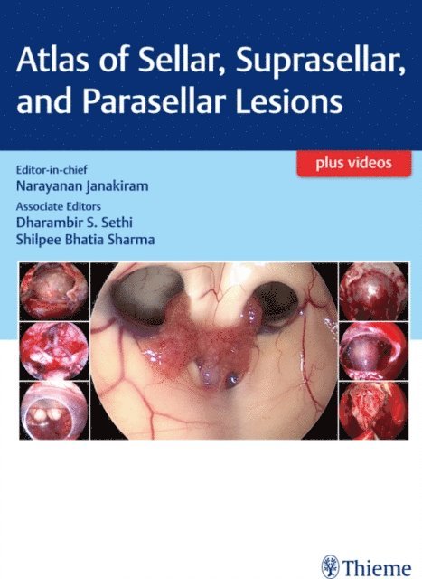 Narayanan Janakiram - Atlas of Sellar, Suprasellar, and Parasellar Lesions, E-bok
