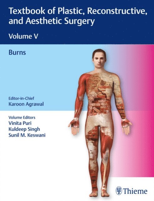 Kuldeep Singh, Vinita Puri, Karoon Agrawal - Textbook of Plastic, Reconstructive, and Aesthetic Surgery, Vol 5, E-bok
