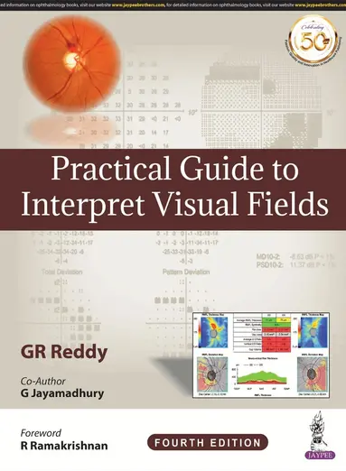 GR Reddy - Practical Guide to Interpret Visual Fields, Inbunden