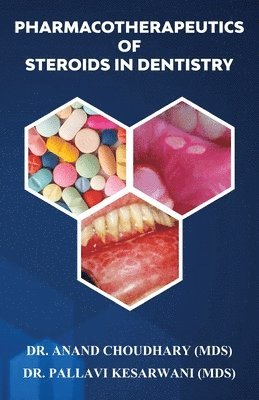 Anand Choudhary - Pharmacotherapeutics of Steroids in Dentistry, Häftad