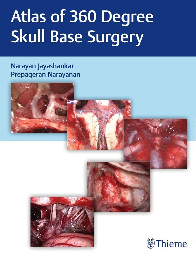 Narayan Jayashankar, Prepageran Narayanan - Atlas of 360 Degree Skull Base Surgery, Inbunden