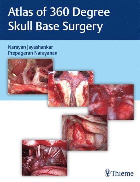 Prepageran Narayanan, Narayan Jayashankar - Atlas of 360 Degree Skull Base Surgery, E-bok