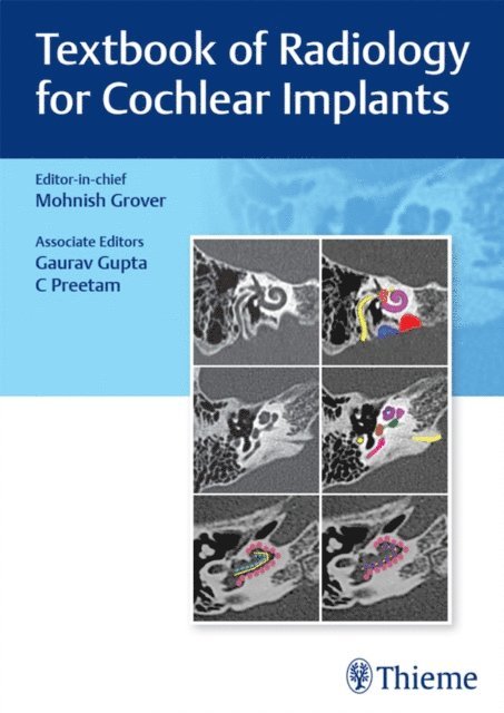 Mohnish Grover - Textbook of Radiology for Cochlear Implants, E-bok