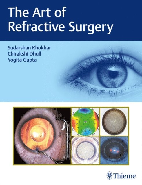 Yogita Gupta, Chirakshi Dhull, Sudarshan Khokhar - Art of Refractive Surgery, E-bok