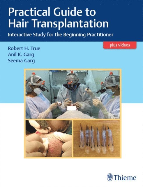 Seema Garg, Anil K. Garg, Roberth H. True - Practical Guide to Hair Transplantation, E-bok
