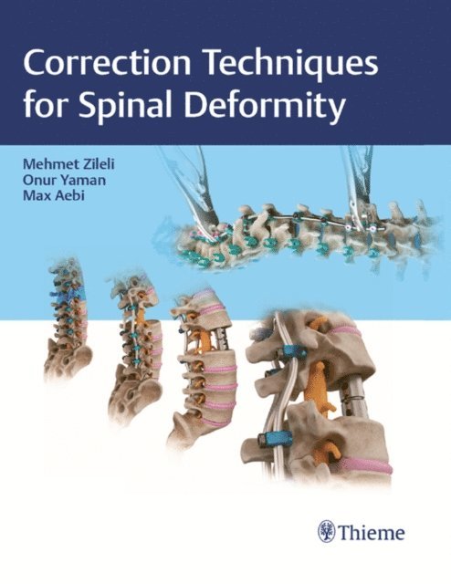 Max Aebi, Onur Yaman, Mehmet Zileli - Correction Techniques for Spinal Deformity, E-bok