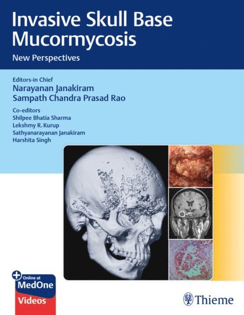 Sampath Chandra Prasad Rao, Narayanan Janakiram - Invasive Skull Base Mucormycosis, E-bok