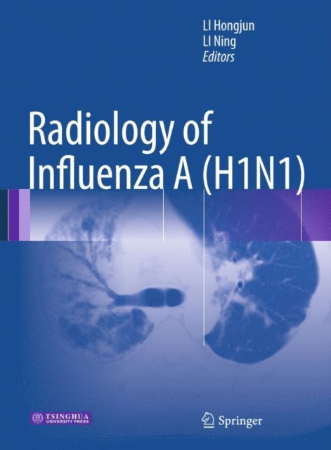 Ning Li, Hongjun Li - Radiology of Influenza A (H1N1), E-bok