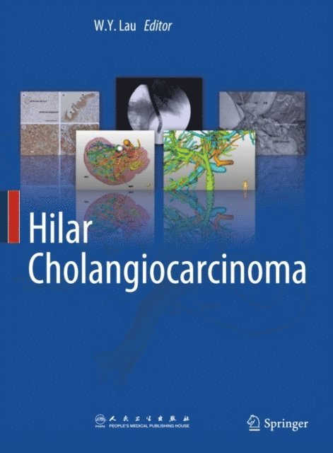 W.Y. Lau - Hilar Cholangiocarcinoma, E-bok. Tillgänglighet: Lägg i varukorg