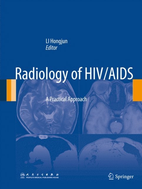 Hongjun Li - Radiology of HIV/AIDS, E-bok