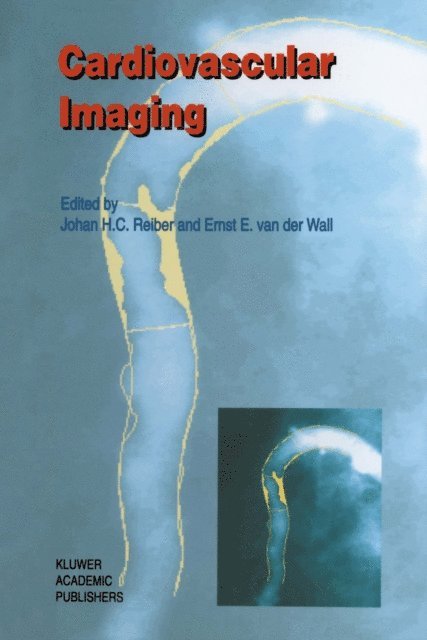 Ernst E. van der Wall, Johan H. C. Reiber - Cardiovascular Imaging, E-bok