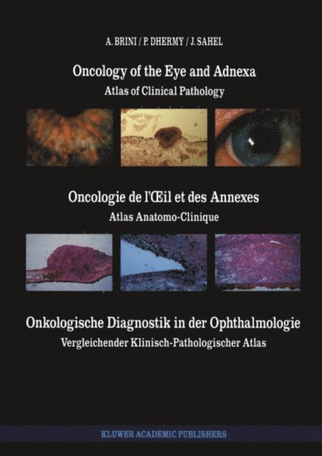 J. Sahel, A. Dhermy, A. Brini - Oncology of the Eye and Adnexa / Oncologie de l' il et des Annexes / Onkologische Diagnostik in der Ophthalmologie, E-bok