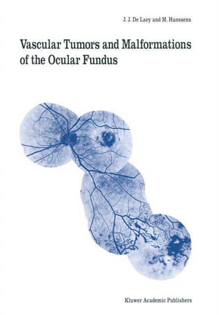 M. Hanssens, J.J. de Laey - Vascular Tumors and Malformations of the Ocular Fundus, E-bok