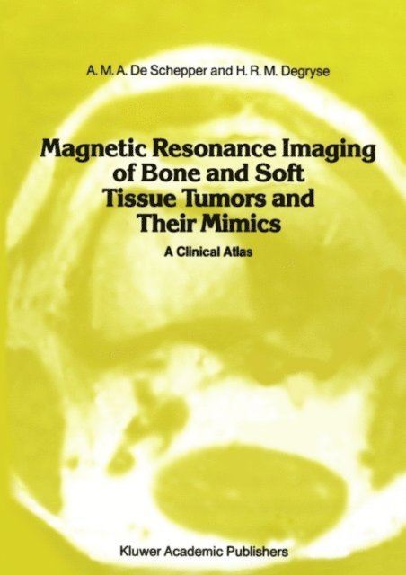 A.D. Degryse, A.M.A. de Schepper - Magnetic Resonance Imaging of Bone and Soft Tissue Tumors and Their Mimics, E-bok