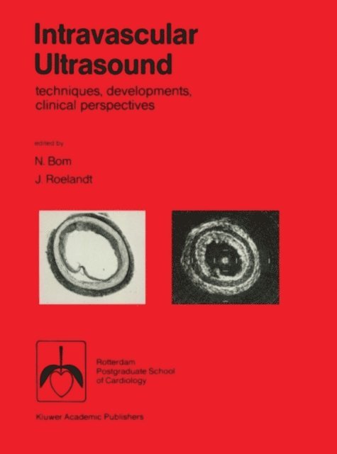 J.R. Roelandt, N. Bom - Intravascular ultrasound, E-bok