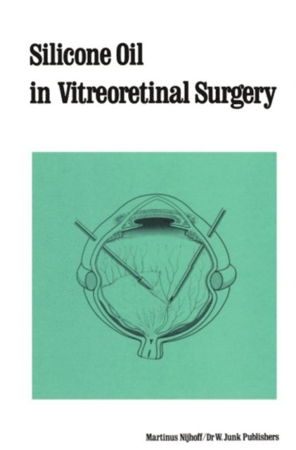 R. Zivojnovic - Silicone Oil in Vitreoretinal Surgery, E-bok