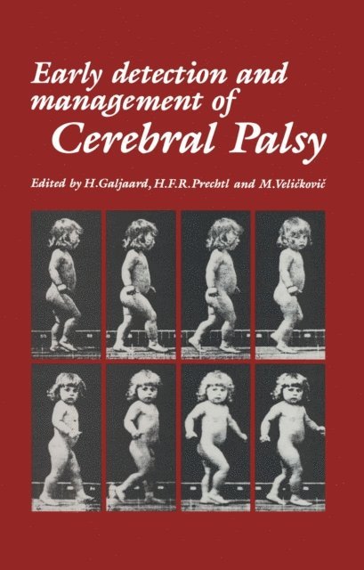 M. Velickovic, H.F.R. Prechtl, H. Galjaard - Early Detection and Management of Cerebral Palsy, E-bok