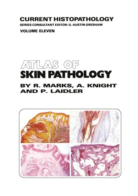 P. Laidler, A.G. Knight, R.M. Marks - Atlas of Skin Pathology, E-bok