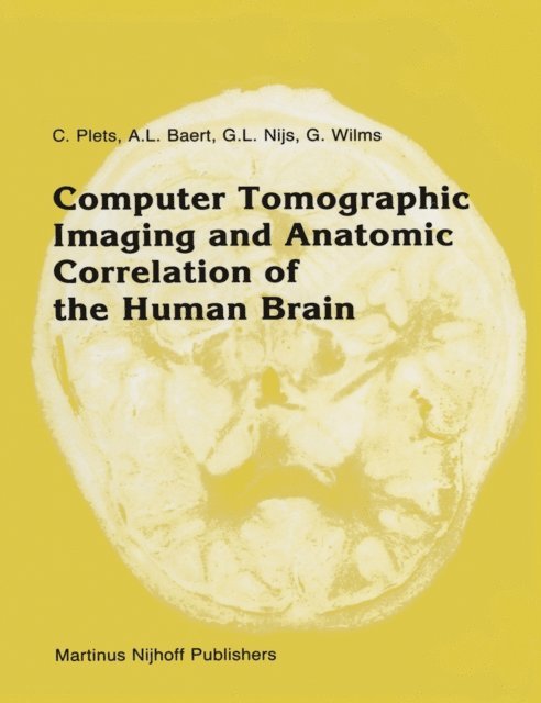 Guido Wilms, G.L. Nijs, A. Baert, C. Plets - Computer Tomographic Imaging and Anatomic Correlation of the Human Brain, E-bok