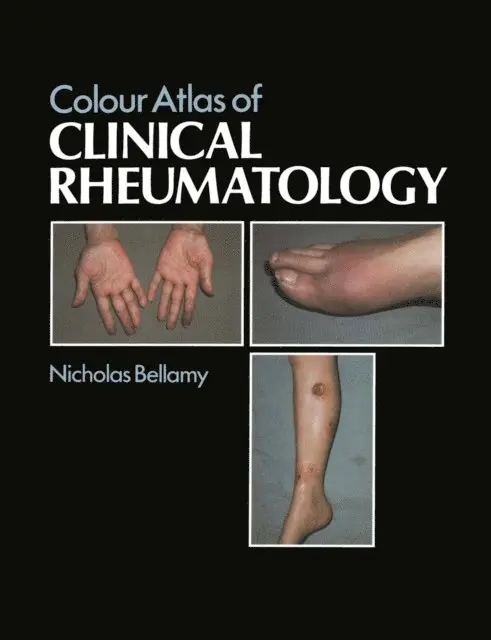 N. Bellamy - Colour Atlas of Clinical Rheumatology, E-bok. Tillgänglighet: Lägg i varukorg