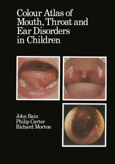 Philip Carter, R.A. Morton, D.J. Bain - Colour Atlas of Mouth, Throat and Ear Disorders in Children, E-bok