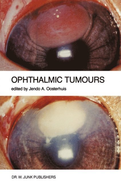 Jendo A. Oosterhuis - Ophthalmic Tumours, E-bok