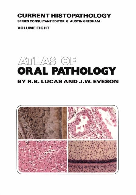 J.W. Eveson, R.B. Lucas - Atlas of Oral Pathology, E-bok