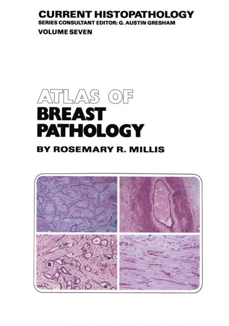 R.R. Millis - Atlas of Breast Pathology, E-bok
