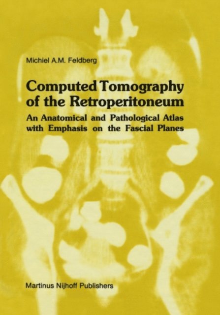 Michiel A.M. Feldberg - Computed Tomography of the Retroperitoneum, E-bok