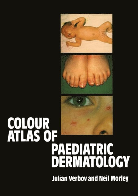 W.N. Morley, J. Verbov - Colour Atlas of Paediatric Dermatology, E-bok