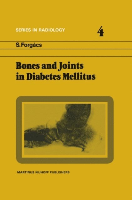 S. Forgacs - Bones and Joints in Diabetes Mellitus, E-bok
