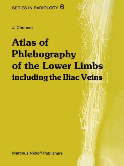 J. Chermet - Atlas of Phlebography of the Lower Limbs, E-bok