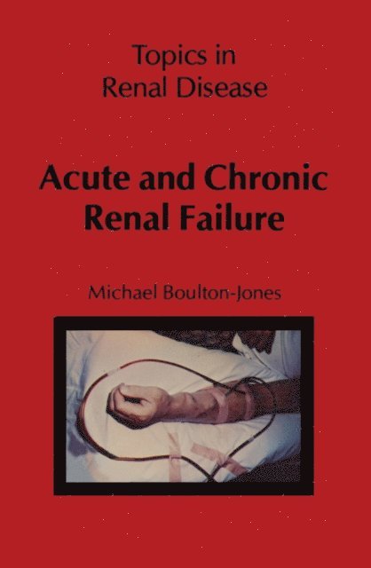 M. Boulton-Jones - Acute and Chronic Renal Failure, E-bok