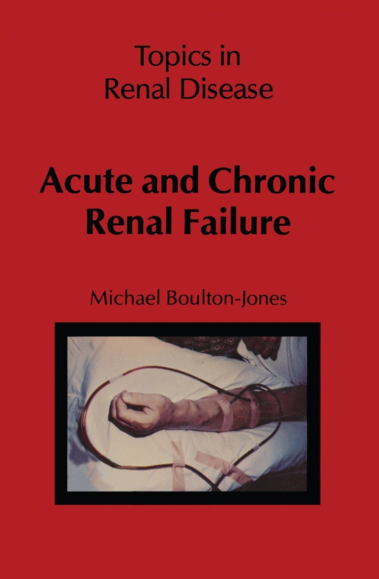 M. Boulton-Jones - Acute and Chronic Renal Failure, Häftad