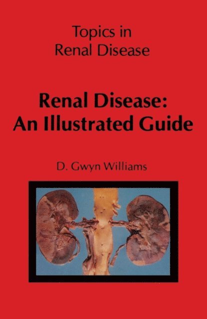 D.G. Williams - Renal Disease: An Illustrated Guide, E-bok